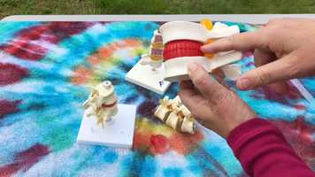 Free download 2a2 Disc Prolapse video and edit with RedcoolMedia movie maker MovieStudio video editor online and AudioStudio audio editor onlin