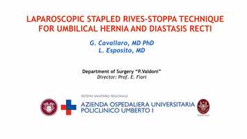 Free download 311/100 Laparoscopic stapled rives-stoppa technique for umbelical hernia and diastasis recti video and edit with RedcoolMedia movie maker MovieStudio video editor online and AudioStudio audio editor onlin