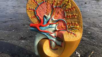 Free download 5B Urinary Intro video and edit with RedcoolMedia movie maker MovieStudio video editor online and AudioStudio audio editor onlin