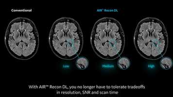 Free download AIR_Recon_DL video and edit with RedcoolMedia movie maker MovieStudio video editor online and AudioStudio audio editor onlin