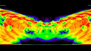 Free download Ankylosing Spodylitis video and edit with RedcoolMedia movie maker MovieStudio video editor online and AudioStudio audio editor onlin