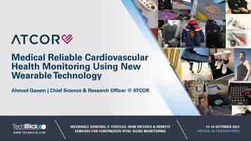 Free download Atcor | Medical Reliable Cardiovascular Health Monitoring Using New Wearable Technology | 13 Oct 2021 | 5 min video and edit with RedcoolMedia movie maker MovieStudio video editor online and AudioStudio audio editor onlin