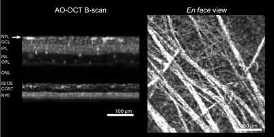 Free download Cellular Scale Imaging of Transparent Retinal Structures and Processes: Supplemental Video 3 video and edit with RedcoolMedia movie maker MovieStudio video editor online and AudioStudio audio editor onlin