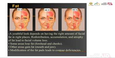 Free download Day-1 Face Muscles-1 video and edit with RedcoolMedia movie maker MovieStudio video editor online and AudioStudio audio editor onlin