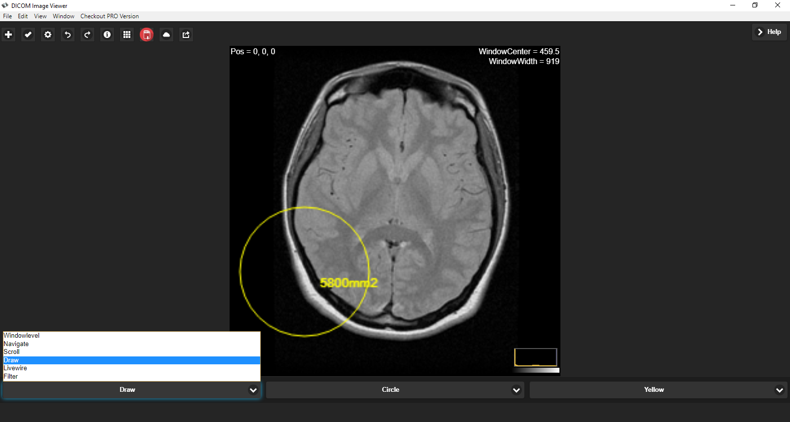 Download web tool or web app DICOM Image Reader Download web tool or web app DICOM Image Reader