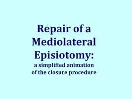 Free download Episiotomy  Repair- Animation of the closure procedure video and edit with RedcoolMedia movie maker MovieStudio video editor online and AudioStudio audio editor onlin