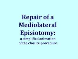 Free download Episiotomy  Repair- Animation of the closure procedure video and edit with RedcoolMedia movie maker MovieStudio video editor online and AudioStudio audio editor onlin