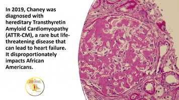 Free download Ex-NBA coach spreads the word about rare heart disease.mp4 video and edit with RedcoolMedia movie maker MovieStudio video editor online and AudioStudio audio editor onlin