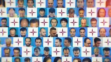 Free download Finasteride Side Effects- Experience of Eugenix team with Hair Transplantation video and edit with RedcoolMedia movie maker MovieStudio video editor online and AudioStudio audio editor onlin