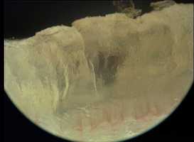 Free download FOREARM SKIN SECTION MOVEMENT EPIDERMIS DERMIS PAPILLARY VESSEL CONTINUITY NONHD 20070920 09.22.13.mov video and edit with RedcoolMedia movie maker MovieStudio video editor online and AudioStudio audio editor onlin