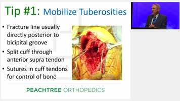 Free download FRI GS - 02 - Evolving Technique Update--Proximal Humerus Tuberosity-Healing with a Hemi- 5 Tips, 5-Minutes - Its Not So Confus video and edit with RedcoolMedia movie maker MovieStudio video editor online and AudioStudio audio editor onlin