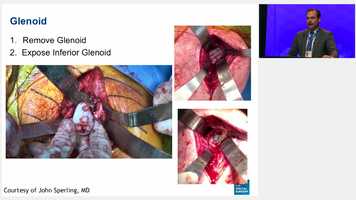 Free download FRI GS - 32 - Evolving Technique- How I Revise-a Total Shoulder to a Reverse-Shoulder Arthroplasty, 7 Minutes --Hold On To Your video and edit with RedcoolMedia movie maker MovieStudio video editor online and AudioStudio audio editor onlin