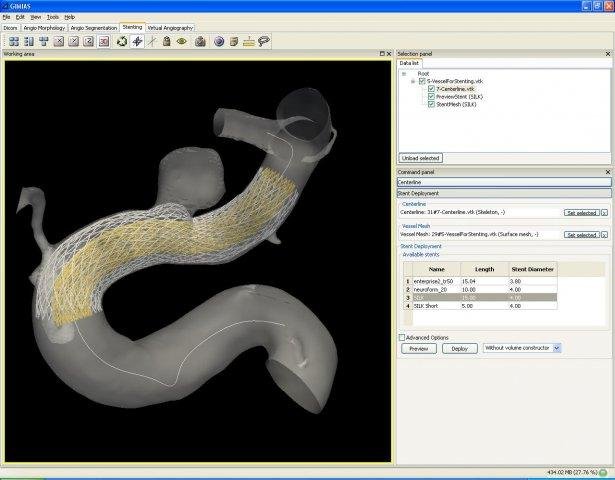 Download web tool or web app Gimias Download web tool or web app Gimias