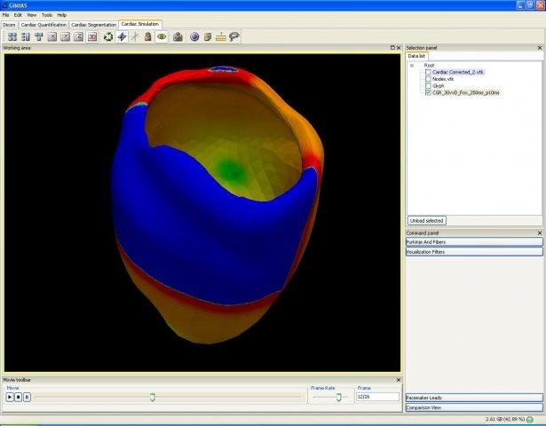 Download web tool or web app Gimias Download web tool or web app Gimias