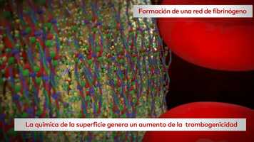 Free download GMT64345 Mucointegration_Animation_Photorealistic ES.mp4 video and edit with RedcoolMedia movie maker MovieStudio video editor online and AudioStudio audio editor onlin