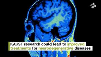 Free download Ground-breaking Work Improves Understanding of Brain Function video and edit with RedcoolMedia movie maker MovieStudio video editor online and AudioStudio audio editor onlin