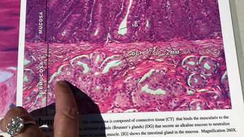 Free download H4a3 Small Intestine Tissues video and edit with RedcoolMedia movie maker MovieStudio video editor online and AudioStudio audio editor onlin