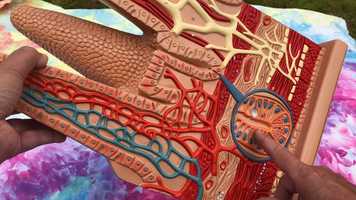 Free download H4b4 Coeliac Disease video and edit with RedcoolMedia movie maker MovieStudio video editor online and AudioStudio audio editor onlin