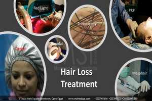 Free download Hair Loss Treatment (Mesohair+PRP+Oygen+Red Light) video and edit with RedcoolMedia movie maker MovieStudio video editor online and AudioStudio audio editor onlin