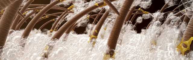 Free download HAIRMAX FOR DENSITY HAIR CARE SYSTEM video and edit with RedcoolMedia movie maker MovieStudio video editor online and AudioStudio audio editor onlin