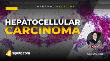 Free download Hepatocellular Carcinoma | Medicine Student Lectures | Medical Education | V-Learning video and edit with RedcoolMedia movie maker MovieStudio video editor online and AudioStudio audio editor onlin