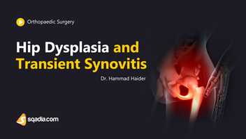 Free download Hip Dysplasia and Transient Synovitis | 1400+ Medical Lectures | V-Learning video and edit with RedcoolMedia movie maker MovieStudio video editor online and AudioStudio audio editor onlin