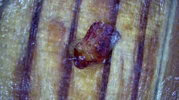 Free download Hip Plastic Bio Film video and edit with RedcoolMedia movie maker MovieStudio video editor online and AudioStudio audio editor onlin