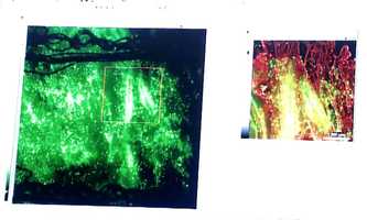 Free download Hôpital Cochin video and edit with RedcoolMedia movie maker MovieStudio video editor online and AudioStudio audio editor onlin