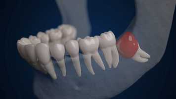 Free download Jawbone3D: An AR iOS app to Teach Oral Pathology video and edit with RedcoolMedia movie maker MovieStudio video editor online and AudioStudio audio editor onlin