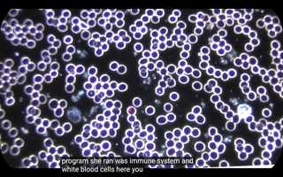 Free download Live Cell Analysis Before and After 1hr Session with the Healy Device video and edit with RedcoolMedia movie maker MovieStudio video editor online and AudioStudio audio editor onlin