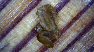 Free download Lower Layer Hip Bio Film video and edit with RedcoolMedia movie maker MovieStudio video editor online and AudioStudio audio editor onlin