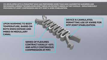 Free download Medical 3D modeling and animation - Xtraverse Implant video and edit with RedcoolMedia movie maker MovieStudio video editor online and AudioStudio audio editor onlin