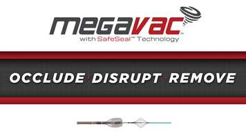 Free download MegaVac Thrombectomy video and edit with RedcoolMedia movie maker MovieStudio video editor online and AudioStudio audio editor onlin