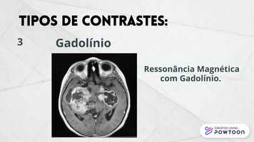 Free download Meios de contrastes utilizados em tcnicas radiolgicas video and edit with RedcoolMedia movie maker MovieStudio video editor online and AudioStudio audio editor onlin