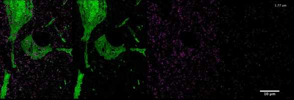 Free download Movie S1 | Immunolabeling determines organelle identity of cytosolic voids in Thy1-YFP expressing neurons video and edit with RedcoolMedia movie maker MovieStudio video editor online and AudioStudio audio editor onlin