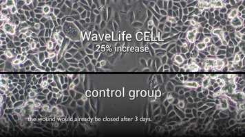 Free download New Technology Speeds Up Wound Healing (SHORT) - 60 seconds video and edit with RedcoolMedia movie maker MovieStudio video editor online and AudioStudio audio editor onlin