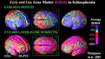 Free download Noah Benzing-  Return video and edit with RedcoolMedia movie maker MovieStudio video editor online and AudioStudio audio editor onlin