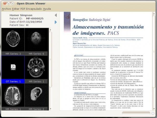 Download web tool or web app Open Dicom Viewer Download web tool or web app Open Dicom Viewer