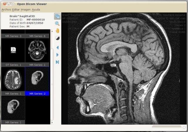 Download web tool or web app Open Dicom Viewer Download web tool or web app Open Dicom Viewer