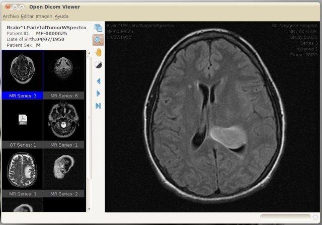 Download web tool or web app Open Dicom Viewer Download web tool or web app Open Dicom Viewer
