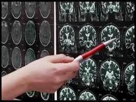 Free download Part 2 - Triggers and Cravings - The Science of Addiction - 3 min video and edit with RedcoolMedia movie maker MovieStudio video editor online and AudioStudio audio editor onlin