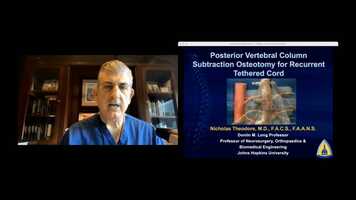 Free download Posterior Vertebral Column Subtraction Osteotomy for Recurrent Tethered Cord Syndrome - Nicholas Theodore, MD video and edit with RedcoolMedia movie maker MovieStudio video editor online and AudioStudio audio editor onlin