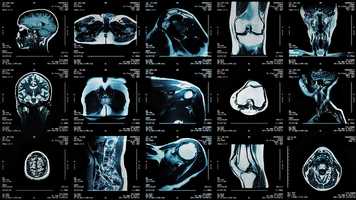 Free download Science In Sport - Brand Film video and edit with RedcoolMedia movie maker MovieStudio video editor online and AudioStudio audio editor onlin