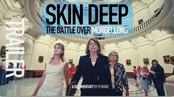 Free download Skin Deep: The Battle Over Morgellons  90 second TRAILER video and edit with RedcoolMedia movie maker MovieStudio video editor online and AudioStudio audio editor onlin