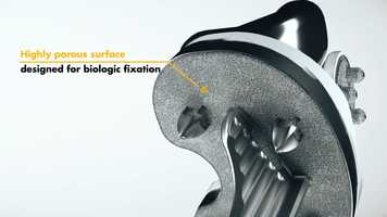 Free download Stryker Knee Construct video and edit with RedcoolMedia movie maker MovieStudio video editor online and AudioStudio audio editor onlin