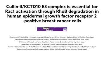 Free download Study reveals promising new target for fighting aggressive breast cancer video and edit with RedcoolMedia movie maker MovieStudio video editor online and AudioStudio audio editor onlin