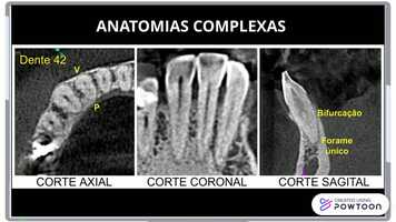 Free download Template_3 video and edit with RedcoolMedia movie maker MovieStudio video editor online and AudioStudio audio editor onlin