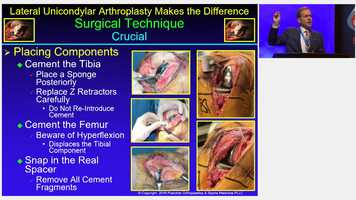 Free download THURS GS - 46 - Evolving Technique- Lateral UKA Makes The Difference In Young Patients With Return To Sports video and edit with RedcoolMedia movie maker MovieStudio video editor online and AudioStudio audio editor onlin