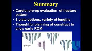 Free download THURS-Monet 3-487-Evolving Technique Update- Periprosthetic Fractures Of The Elbow-David Ruch, MD video and edit with RedcoolMedia movie maker MovieStudio video editor online and AudioStudio audio editor onlin