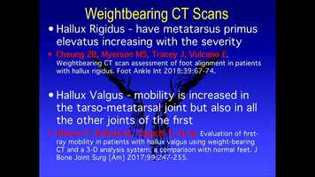 Free download THURS RM6 - 42 - Mini-Honored Professor Thoughts--Evolving Technique- Weightbearing CT-Scans For Foot  Ankle Surgeons video and edit with RedcoolMedia movie maker MovieStudio video editor online and AudioStudio audio editor onlin
